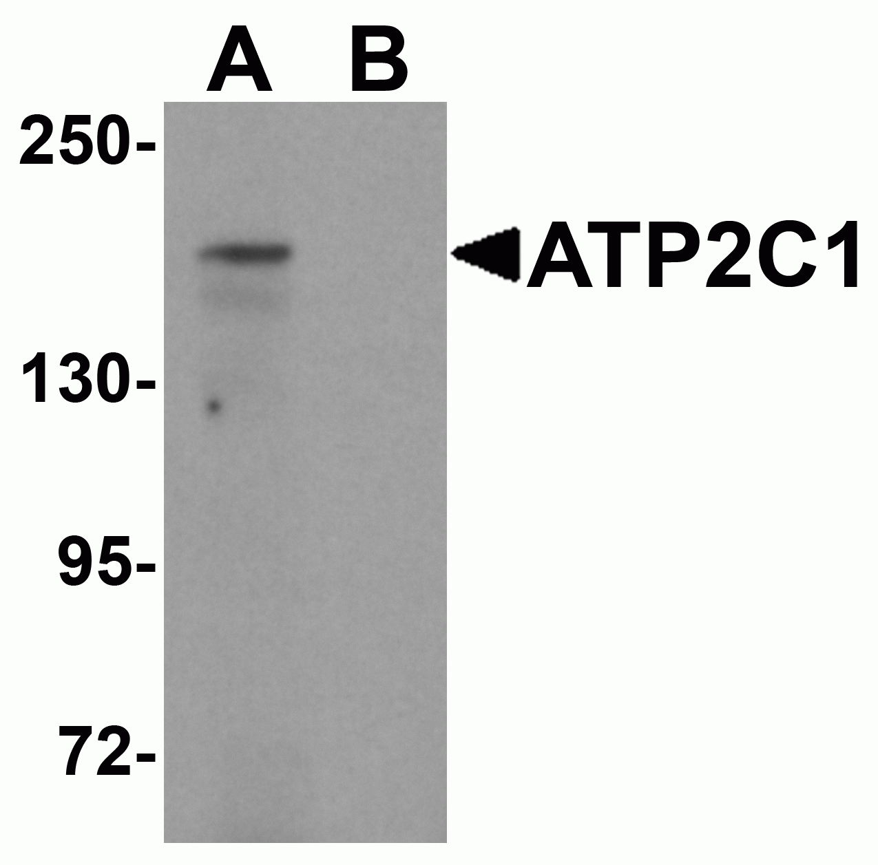 ATP2C1 Antibody