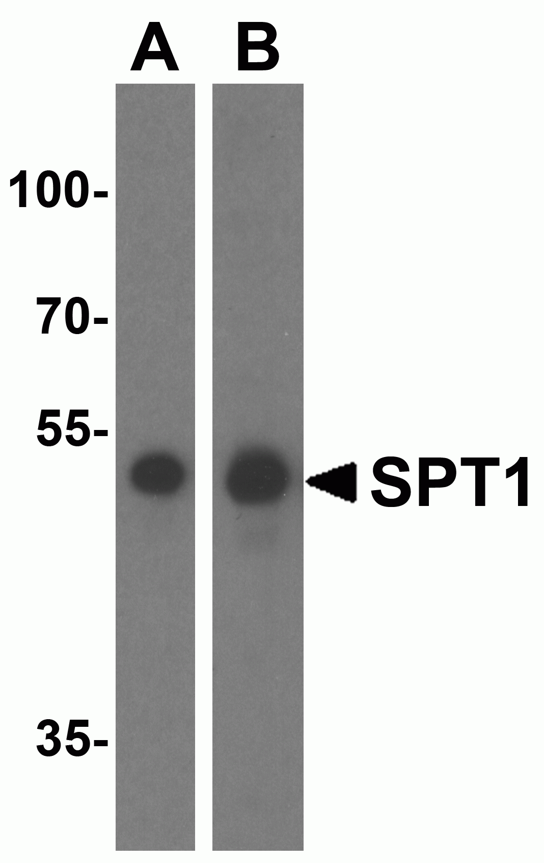SPT1 Antibody