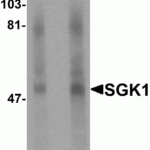 Western blot analysis of SGK1 in human stomach tissue lysate with SGK1 antibody at (A) 1 and (B) 2 μg/mL.