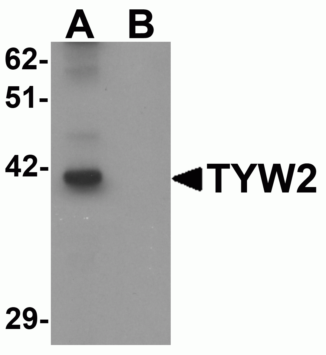 TYW2 Antibody