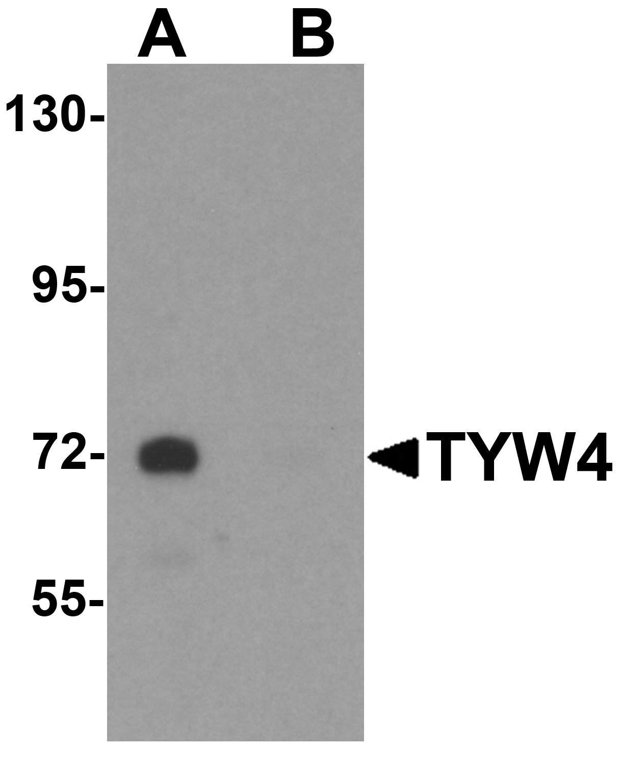 TYW4 Antibody