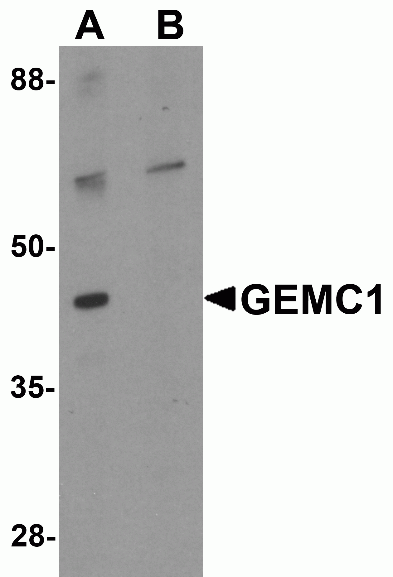 GEMC1 Antibody