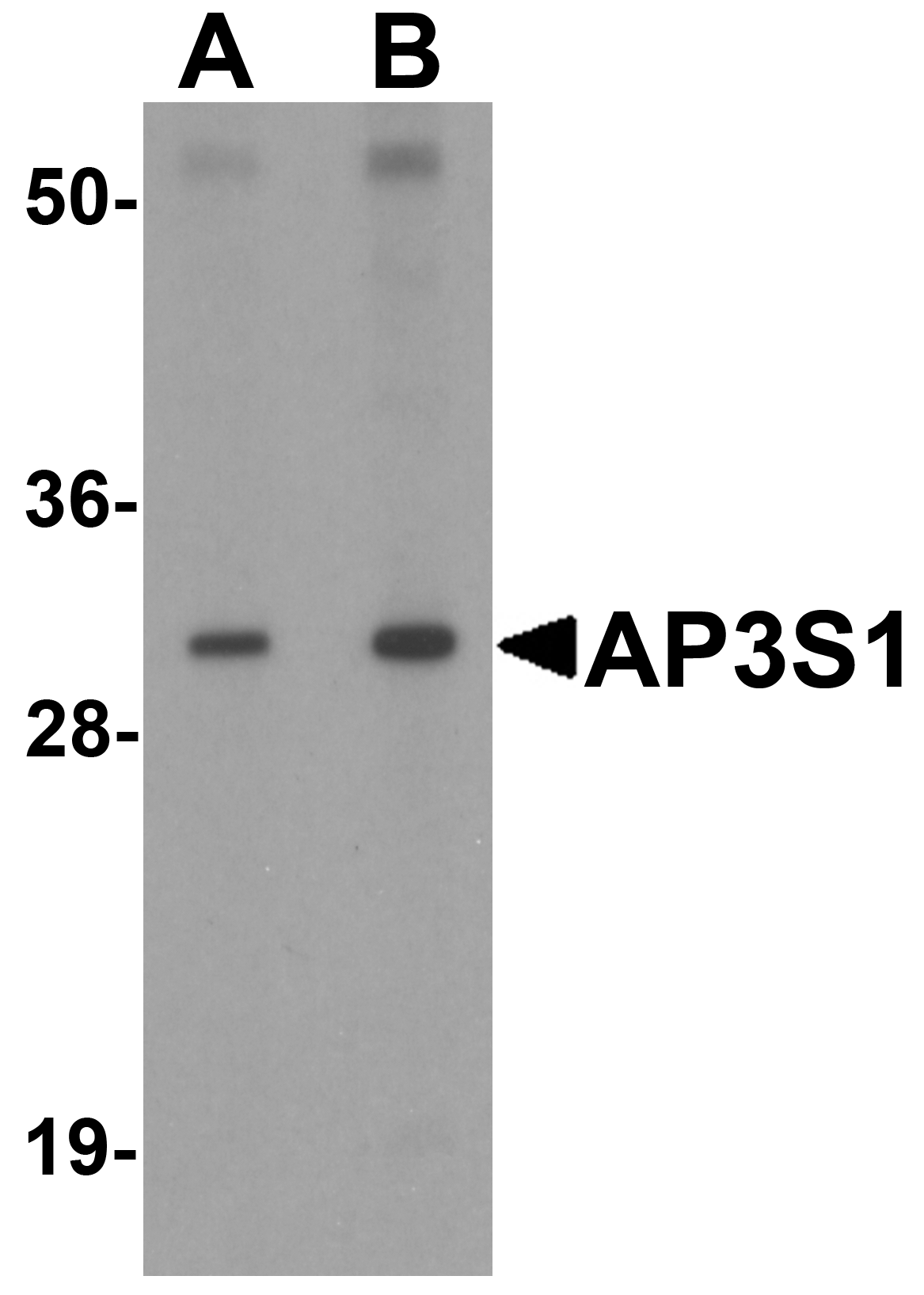 AP3S1 Antibody