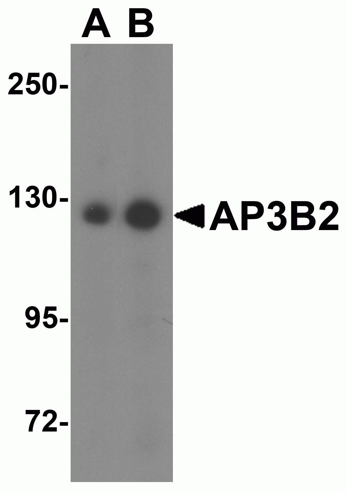 AP3B2 Antibody