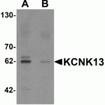Western blot analysis of KCNK13 in rat brain tissue lysate with KCNK13 antibody at 0.5 μg/mL in (A) the absence and (B) the presence of blocking peptide.