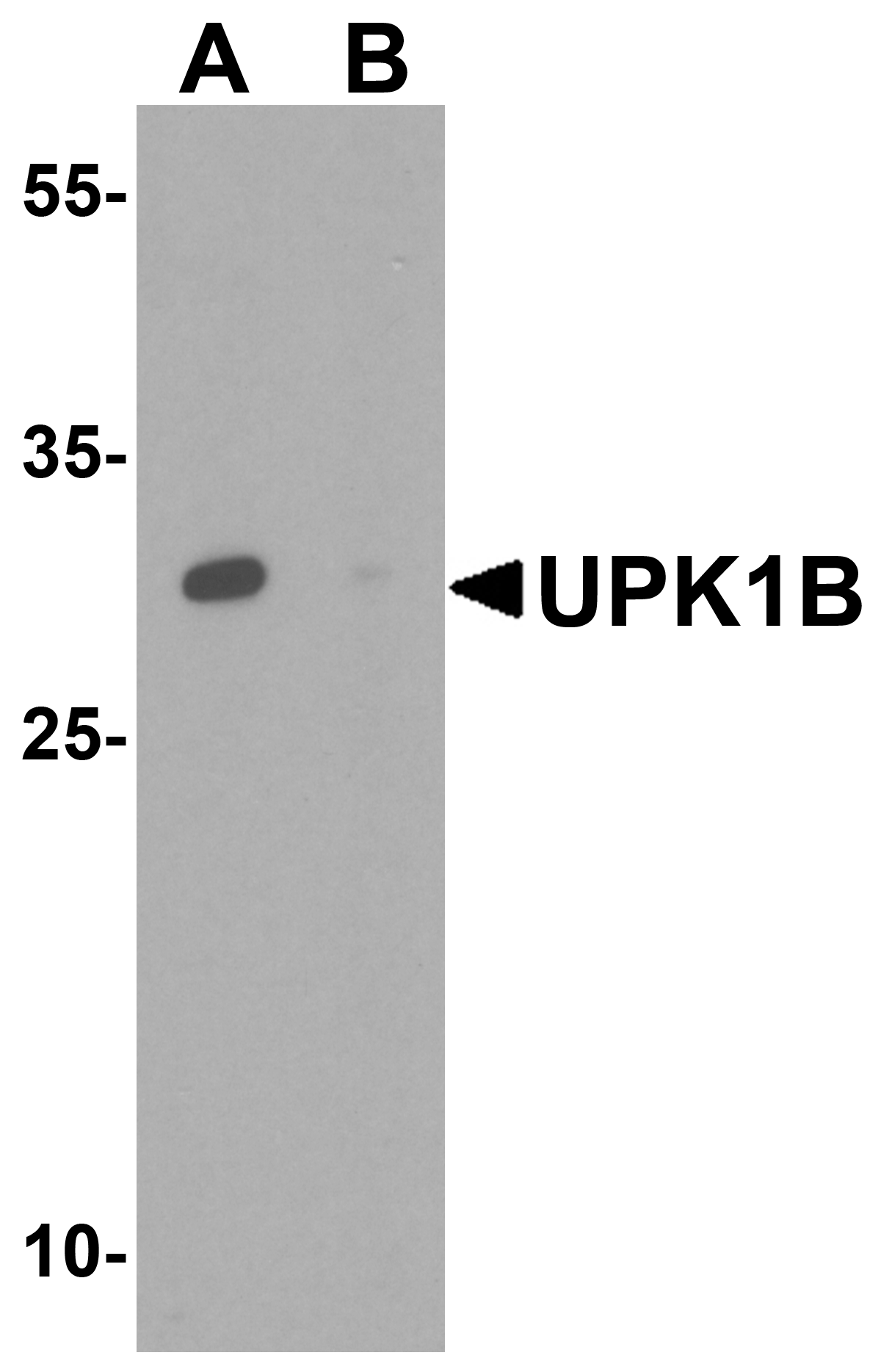 UPK1B Antibody