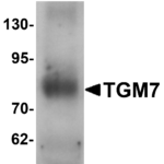 Western blot analysis of TGM7 in human lung tissue lysate with TGM7 antibody at 1 μg/mL.