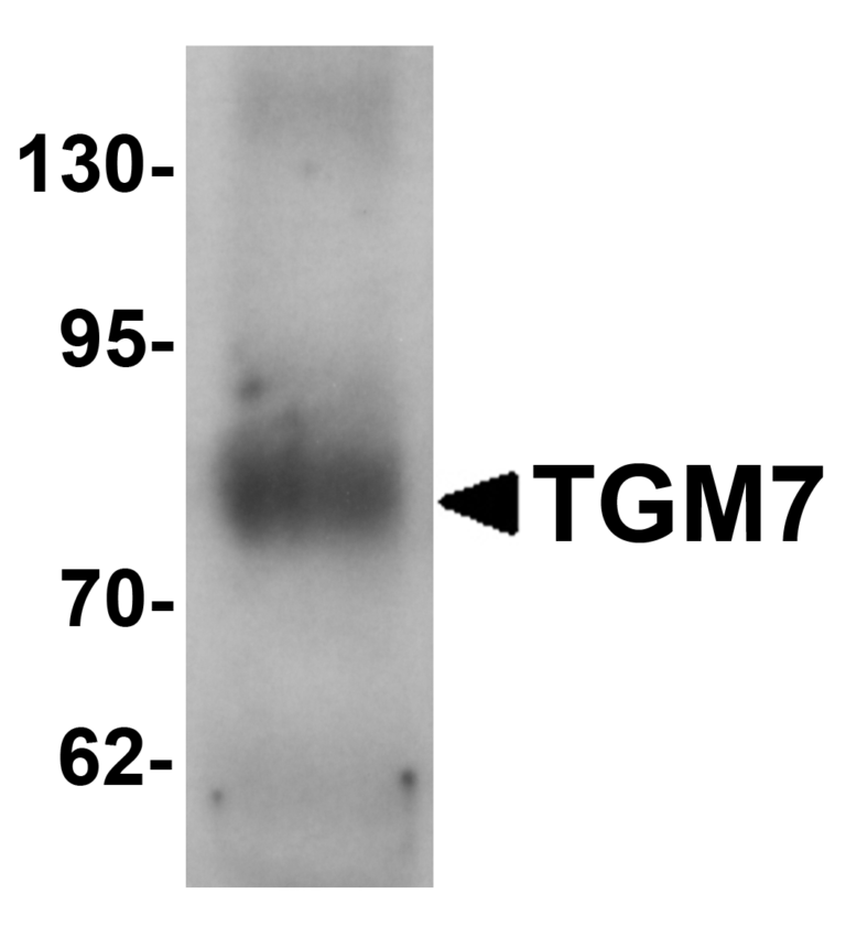 TGM7 Antibody
