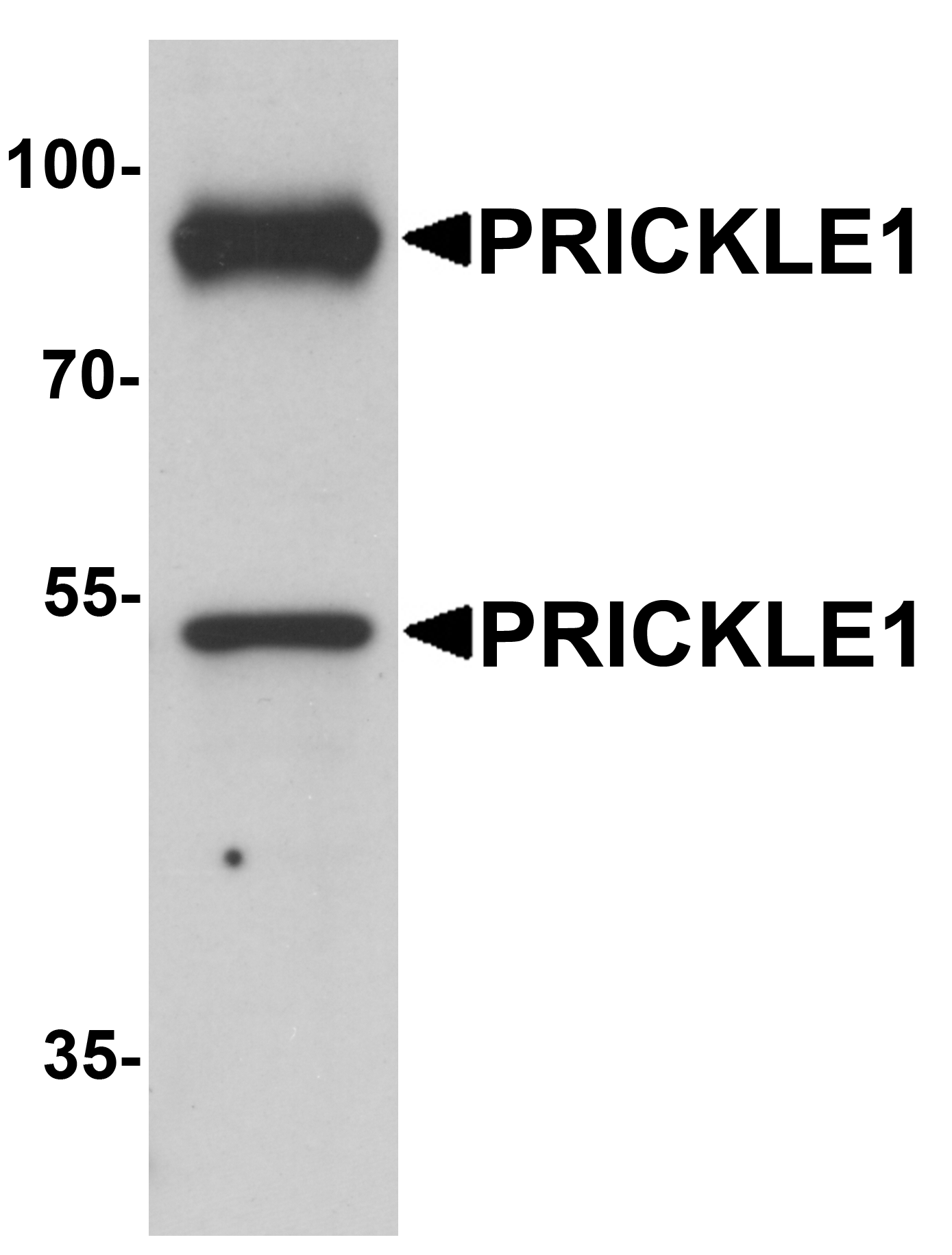 PRICKLE1 Antibody