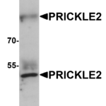 Western blot analysis of PRICKLE2 in A-20 lysate with PRICKLE2 antibody at 1 μg/mL.