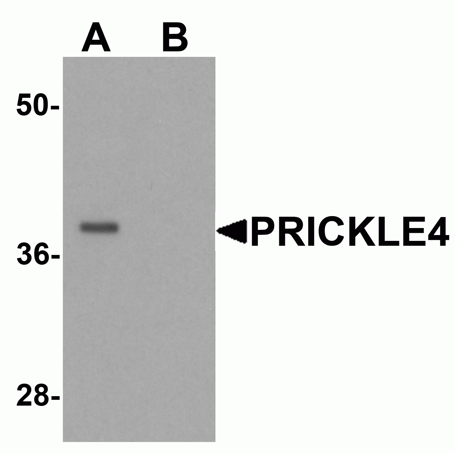 PRICKLE4 Antibody