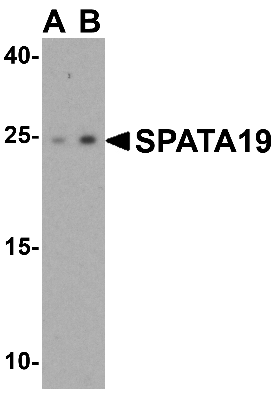 SPATA19 Antibody
