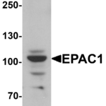 Western blot analysis of EPAC1 in rat skeletal muscle tissue lysate with EPAC1 antibody at 1 μg/mL.