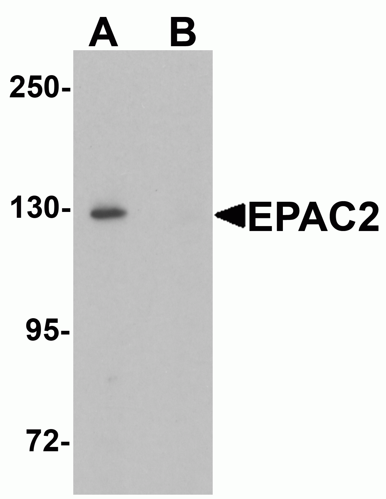 EPAC2 Antibody