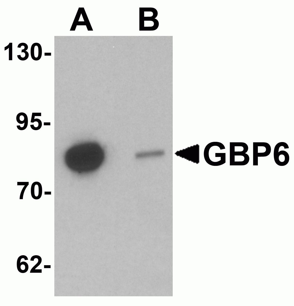 GBP6 Antibody