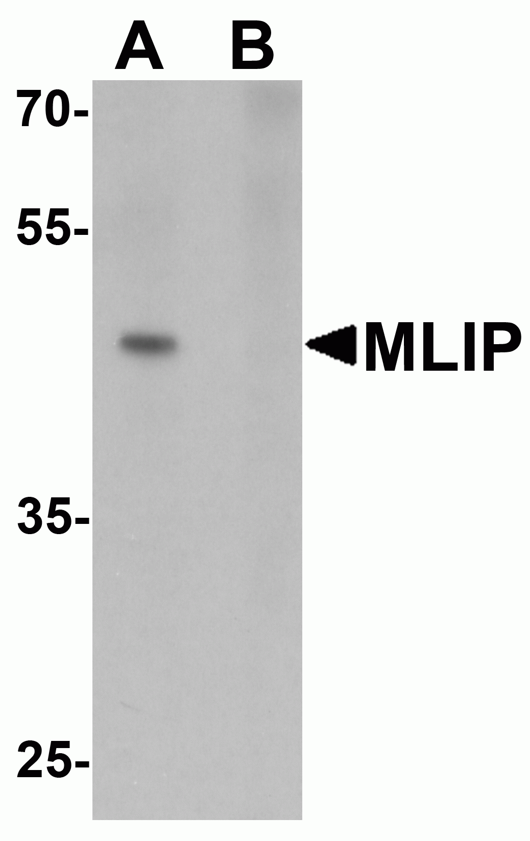MLIP Antibody