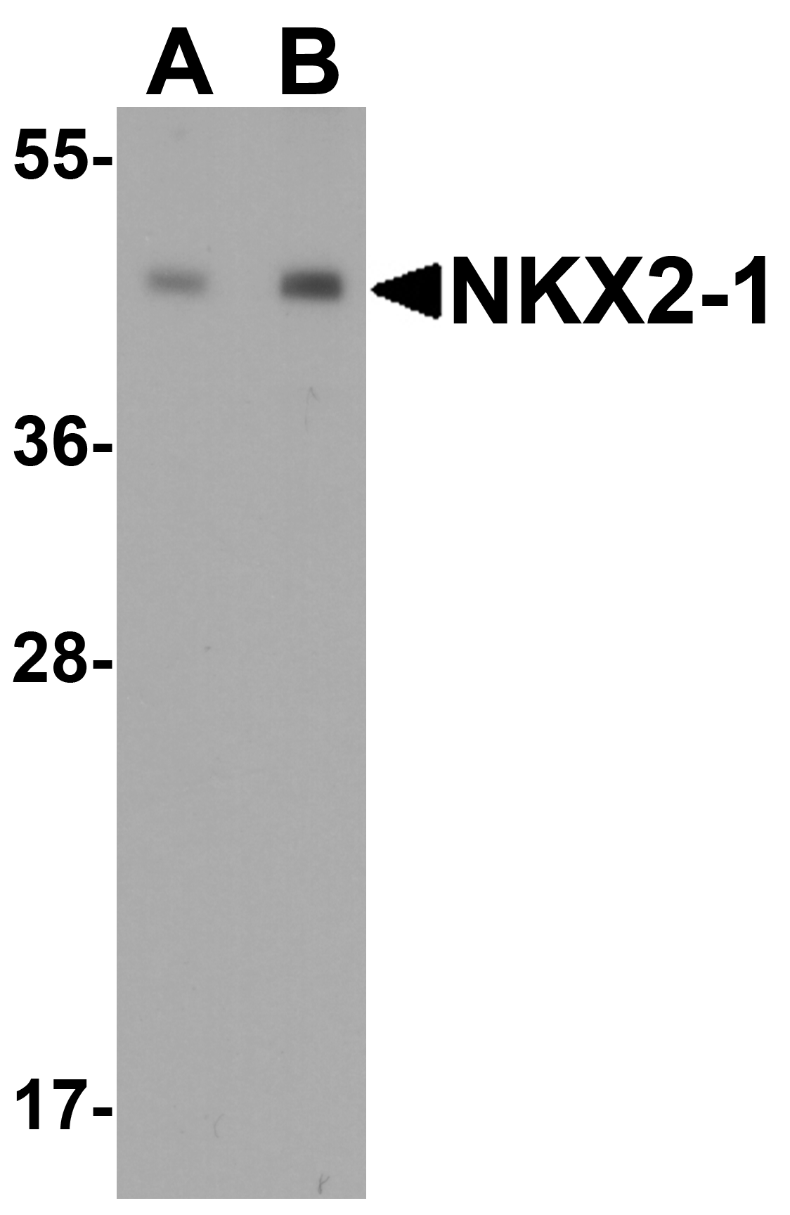NKX2-1 Antibody