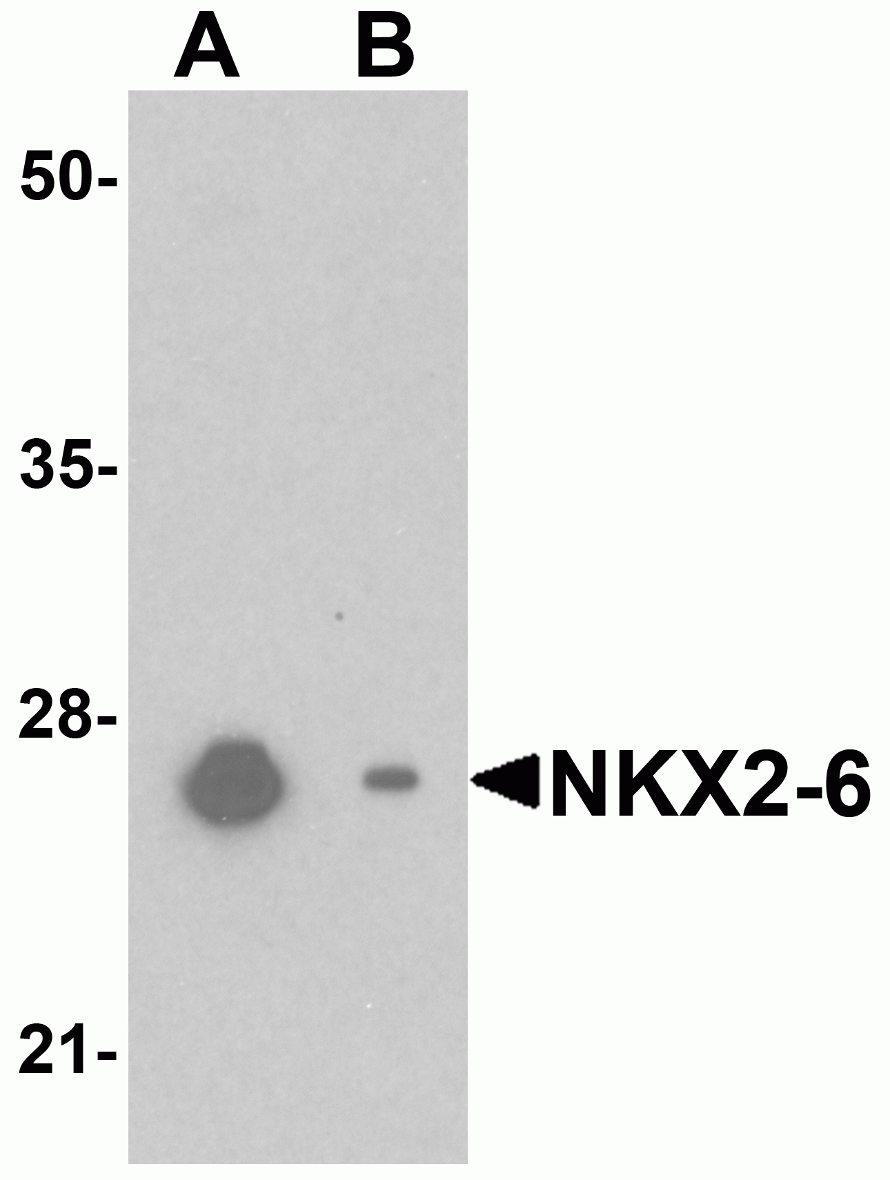 NKX2-6 Antibody