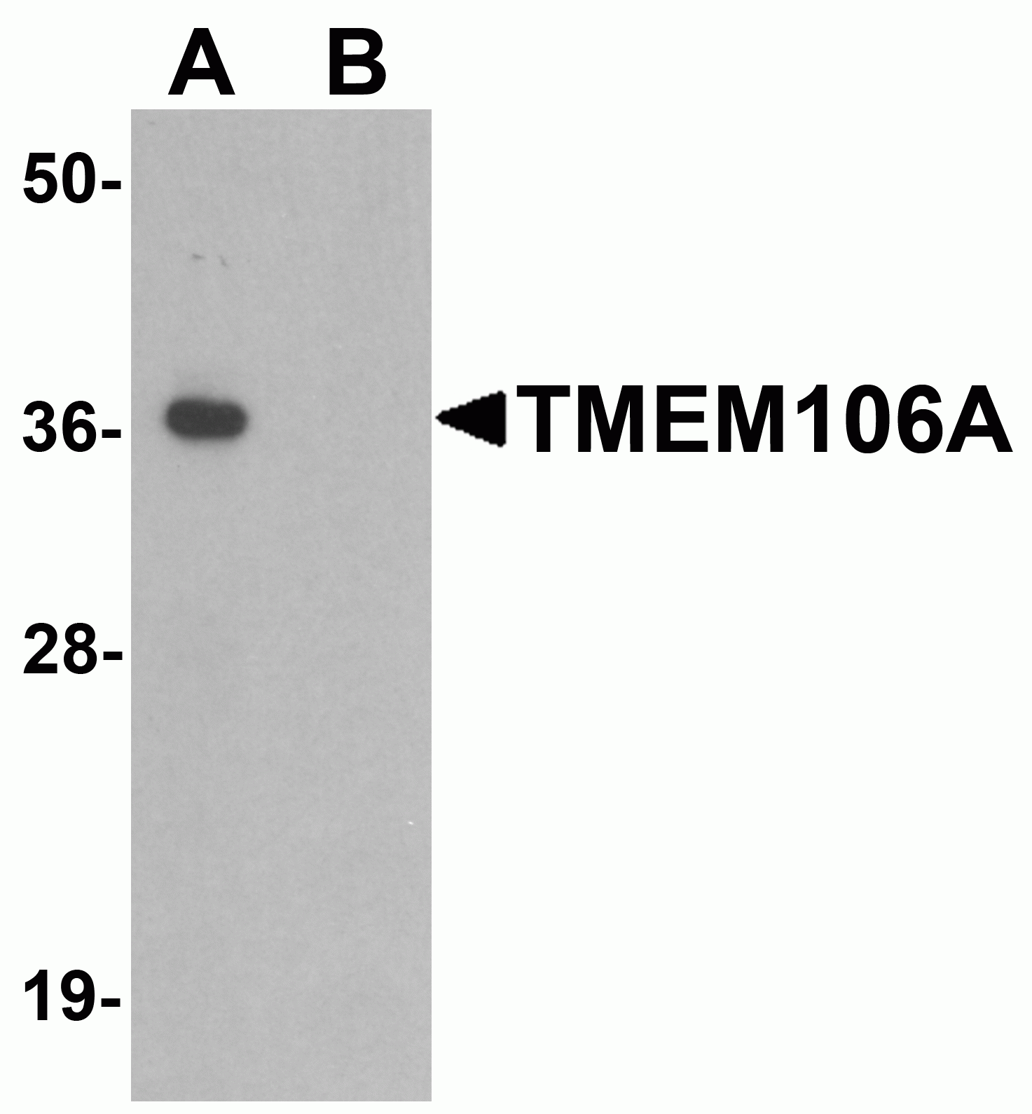 TMEM106A Antibody
