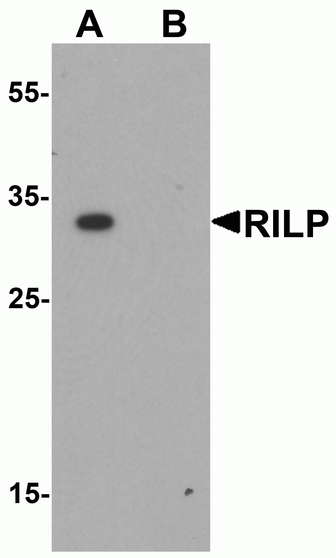 RILP Antibody