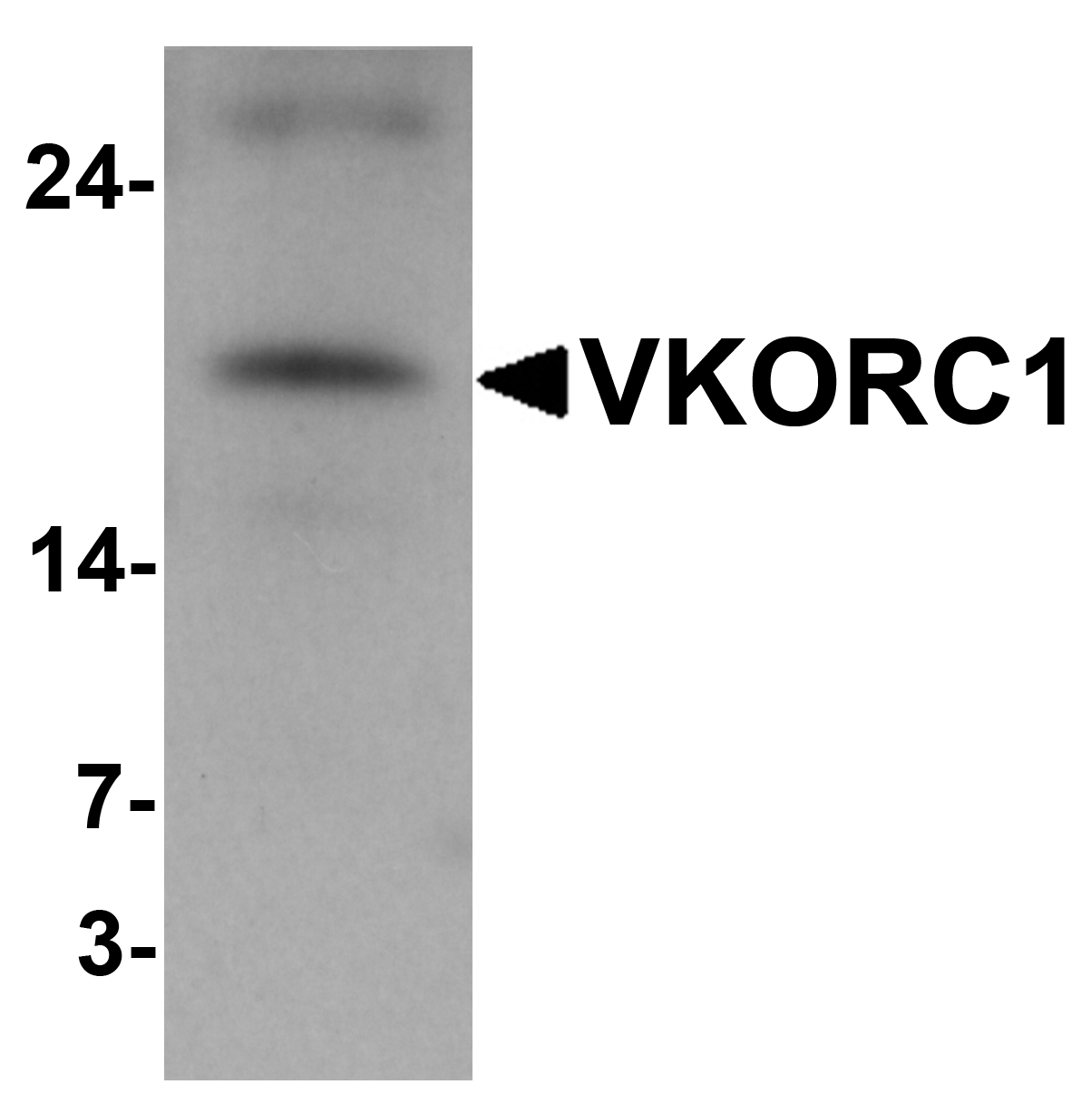 VKORC1 Antibody