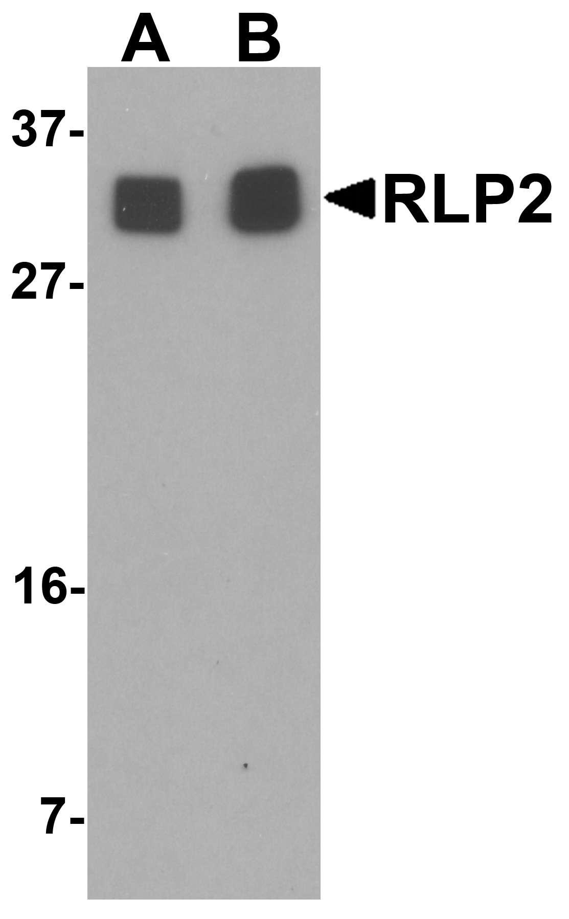 RLP2 Antibody