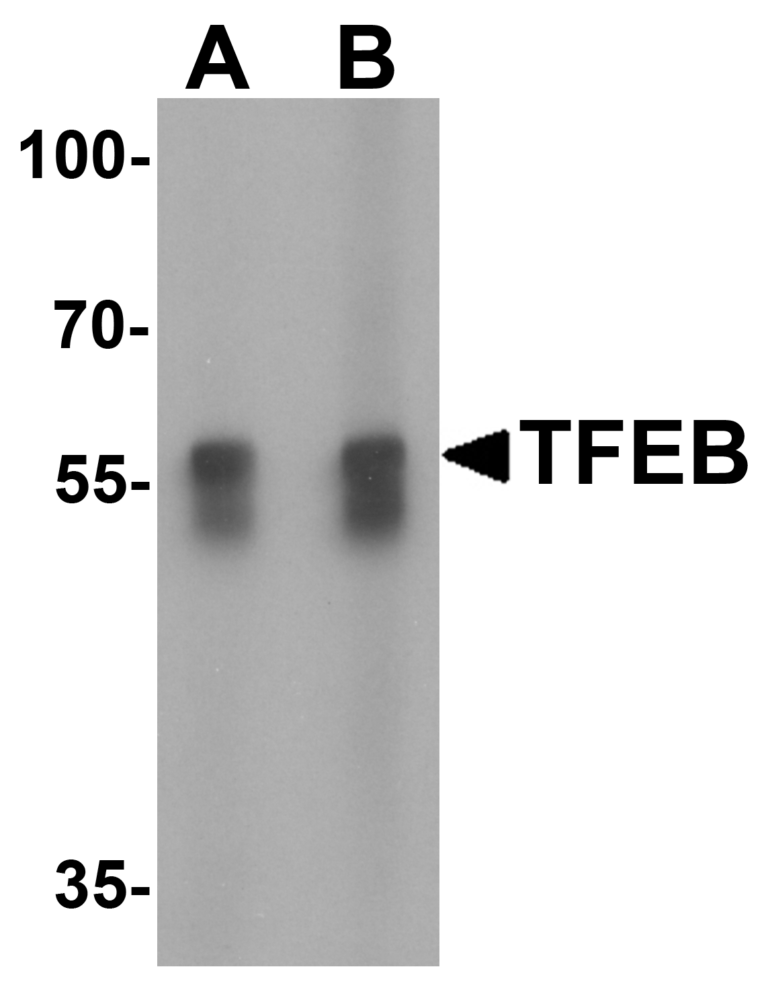 TFEB Antibody