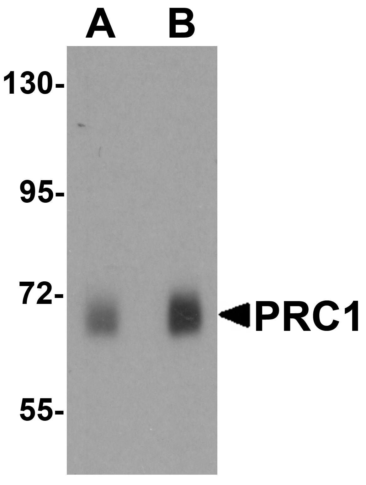 PRC1 Antibody