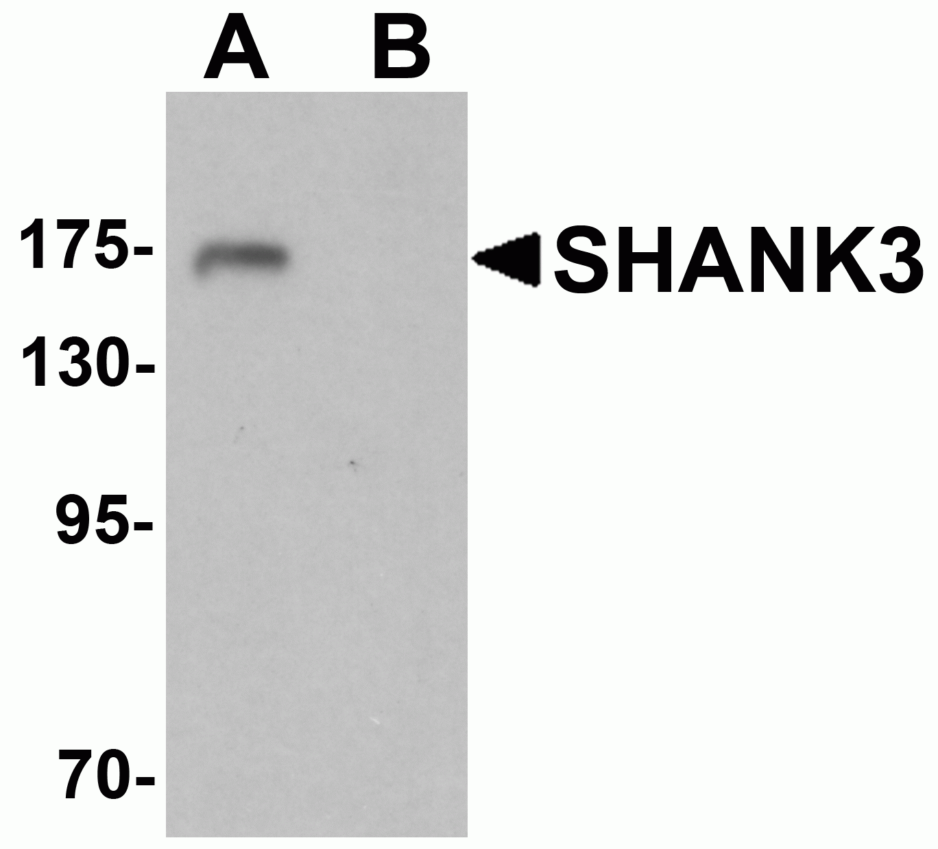 SHANK3 Antibody
