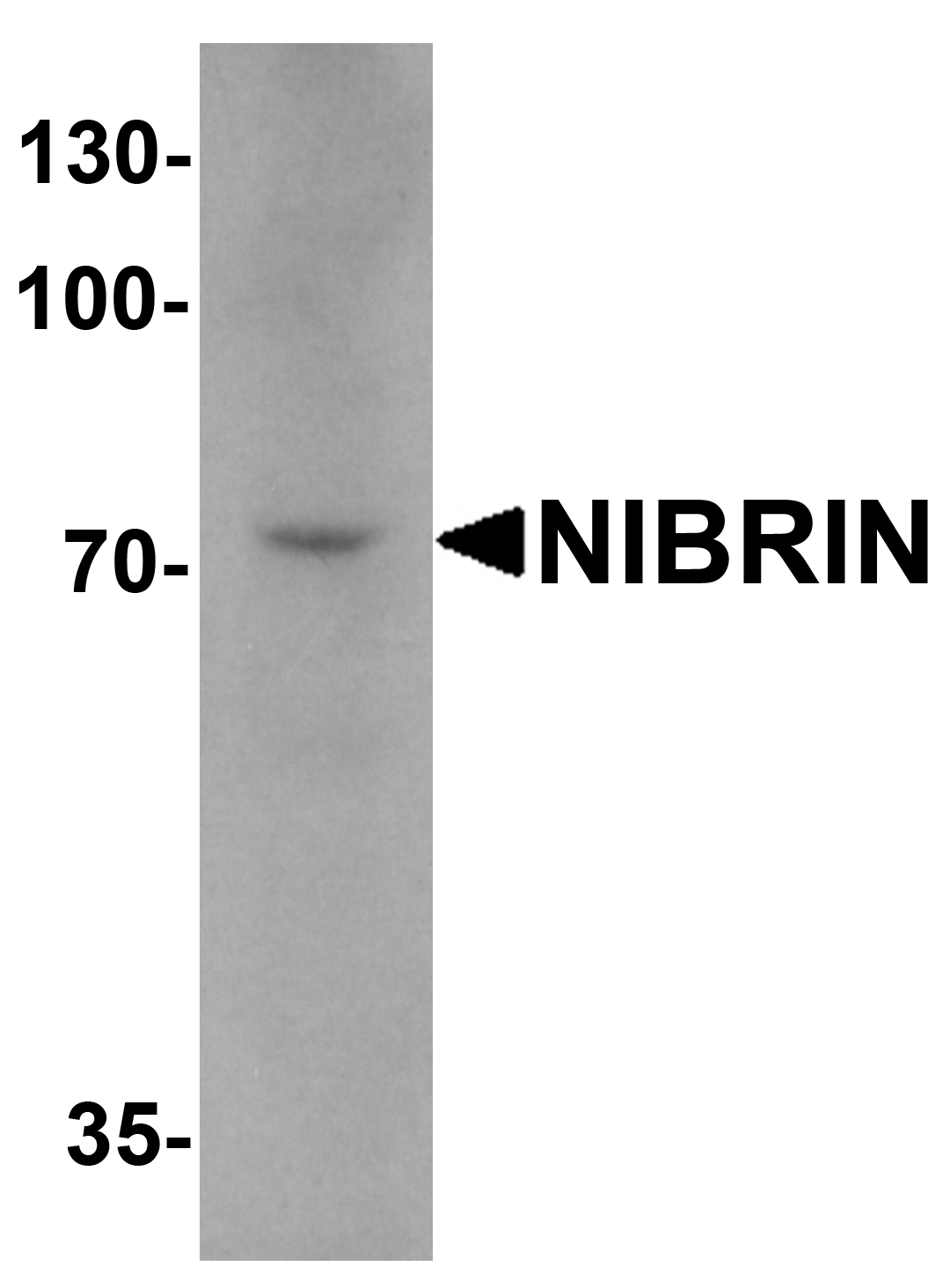 NIBRIN Antibody