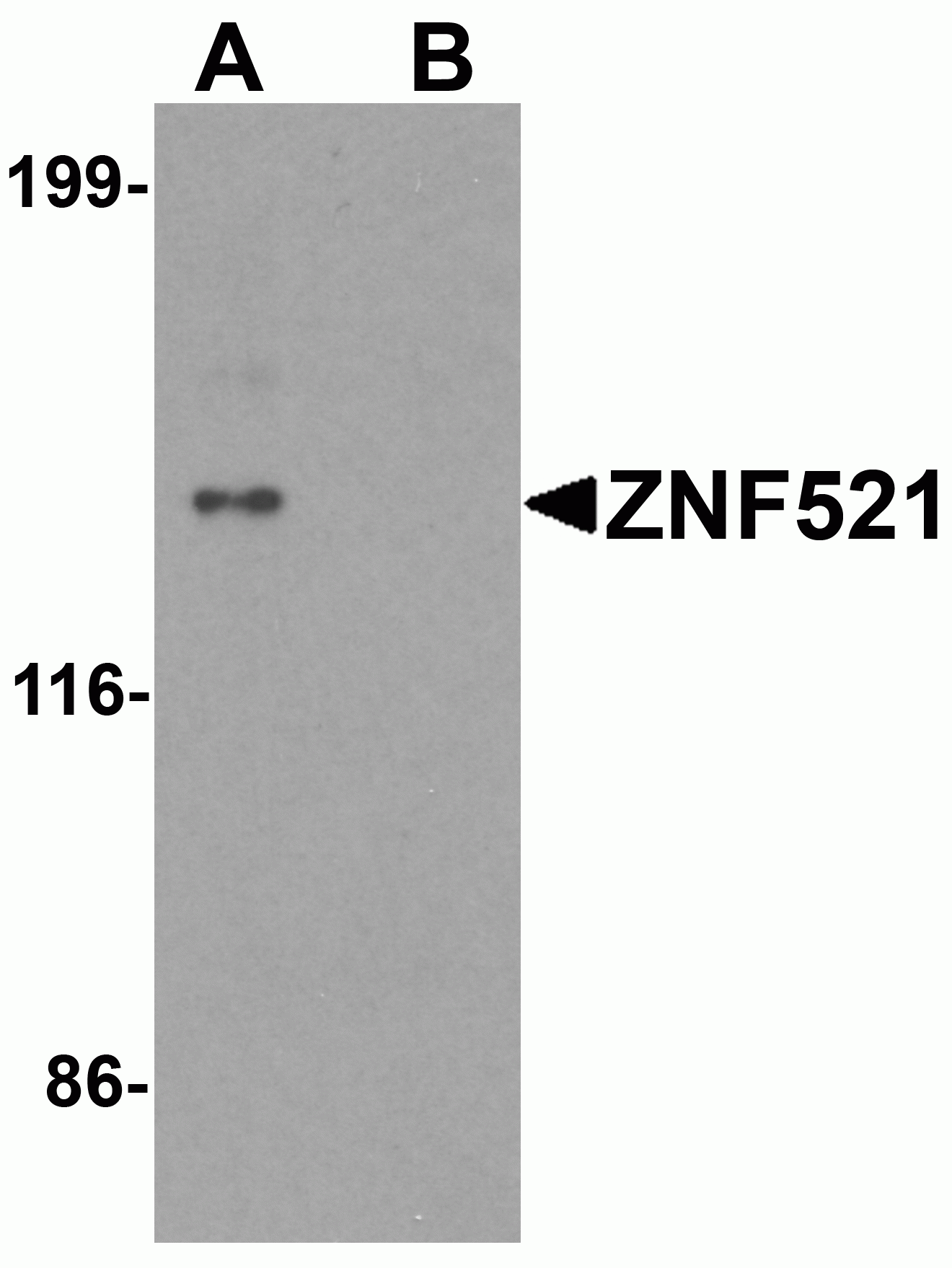 ZNF521 Antibody