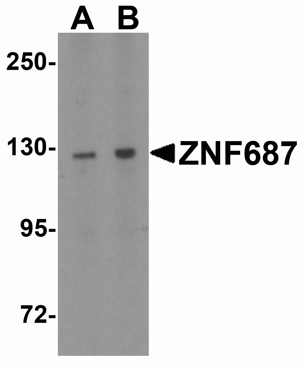 ZNF687 Antibody