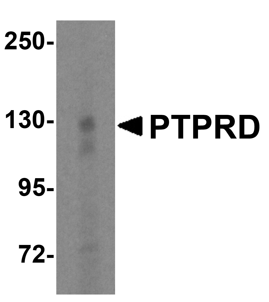 PTPRD Antibody