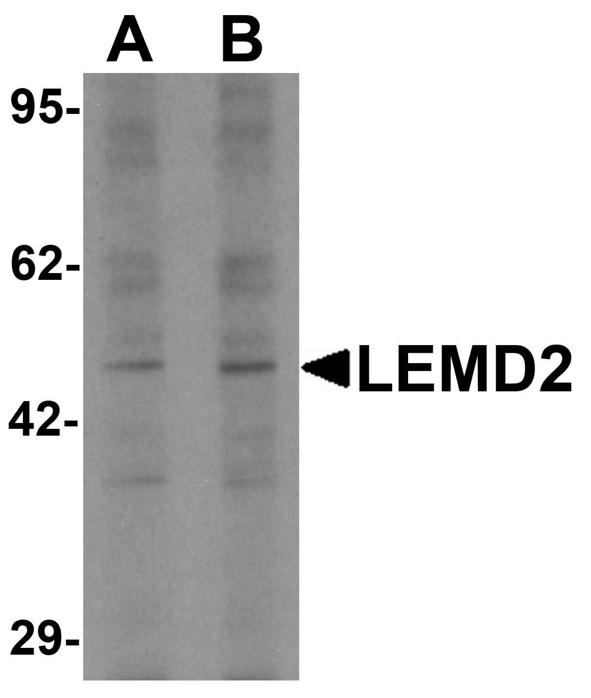 LEMD2 Antibody