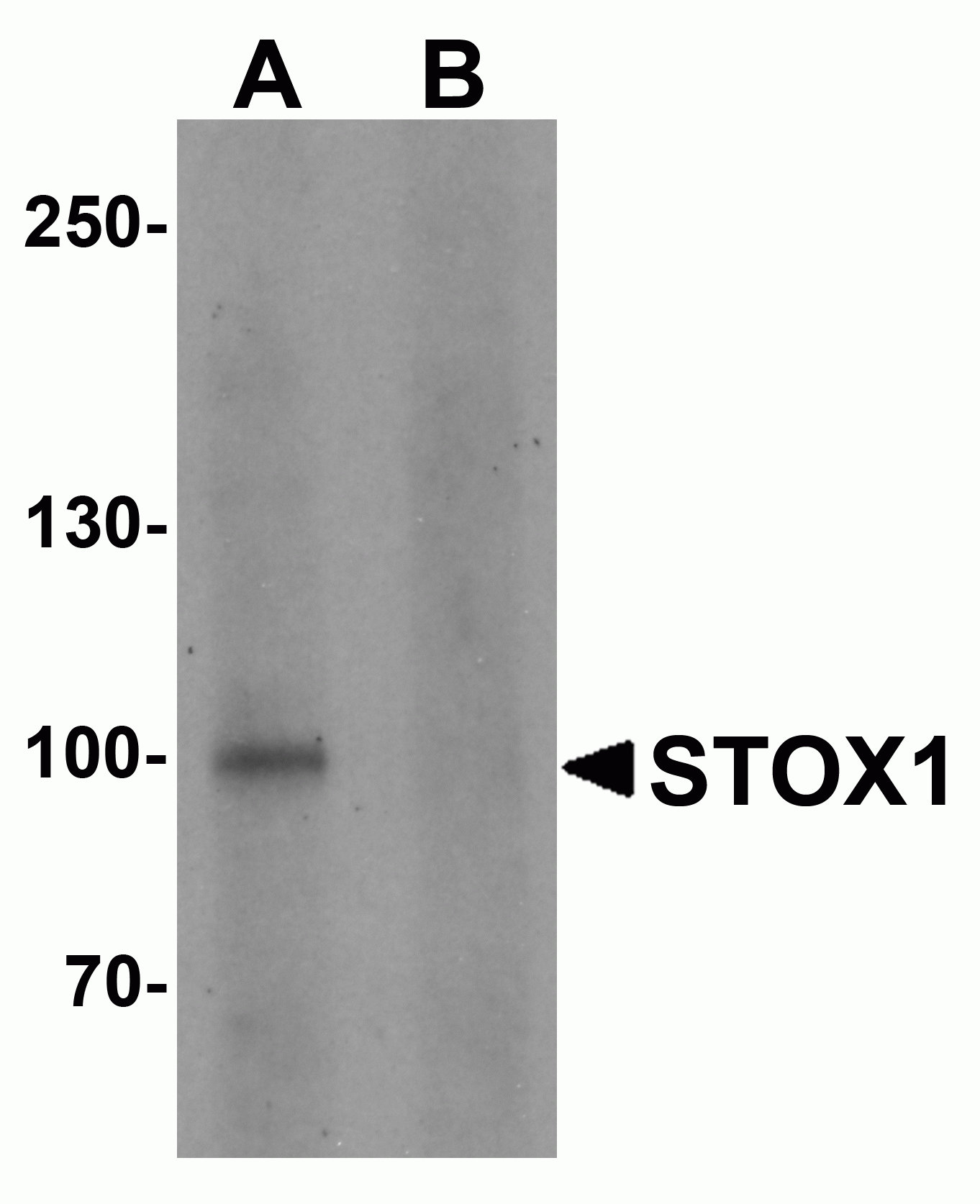 STOX1 Antibody