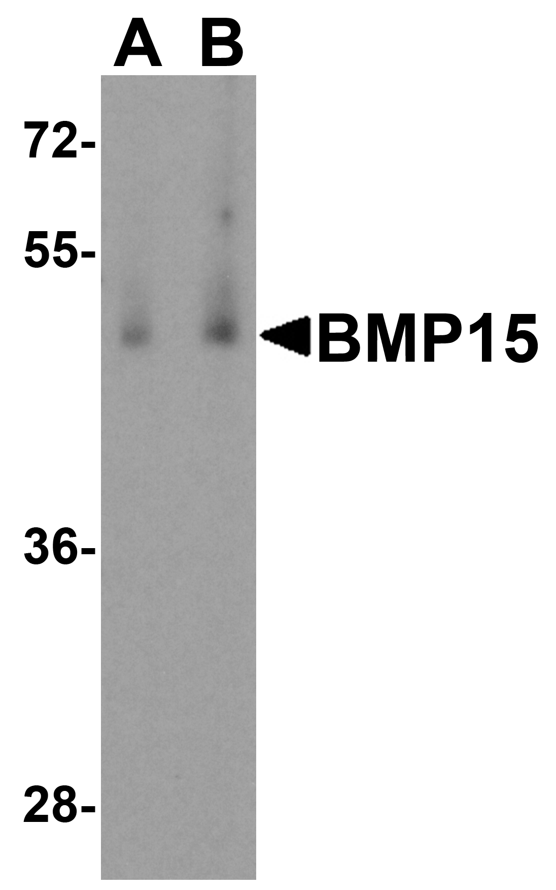 BMP15 Antibody