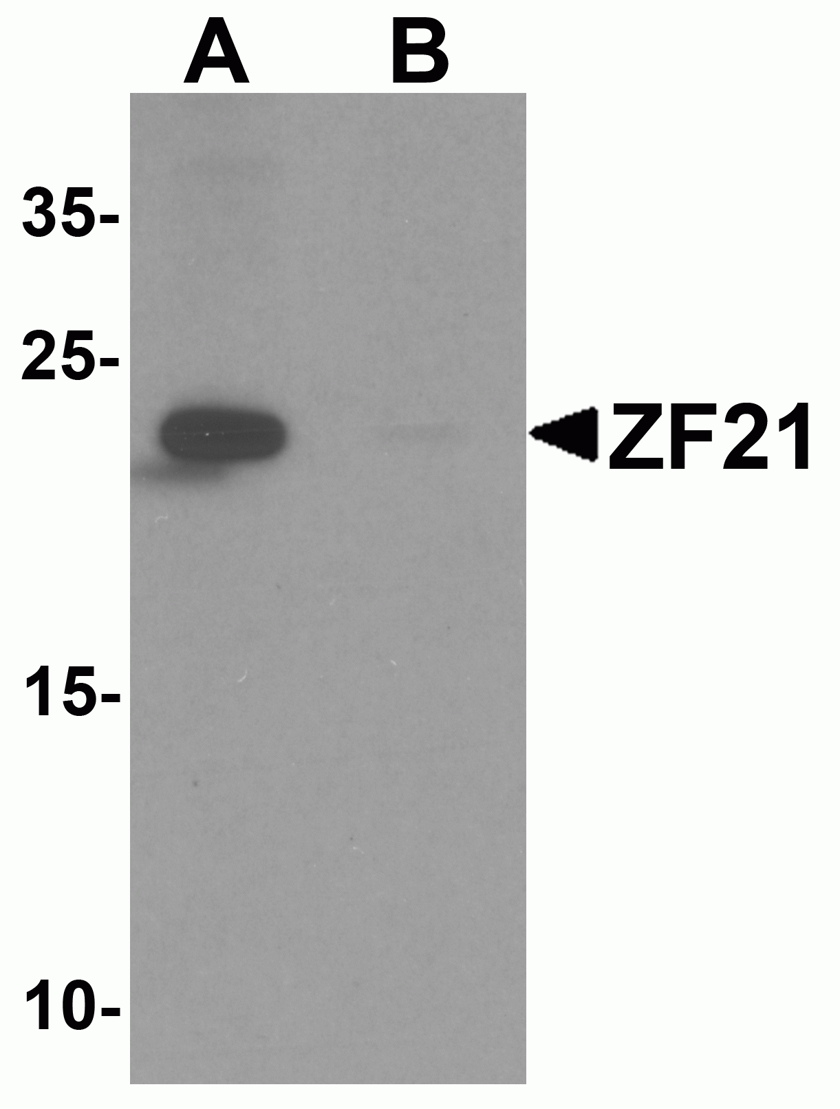 ZF21 Antibody