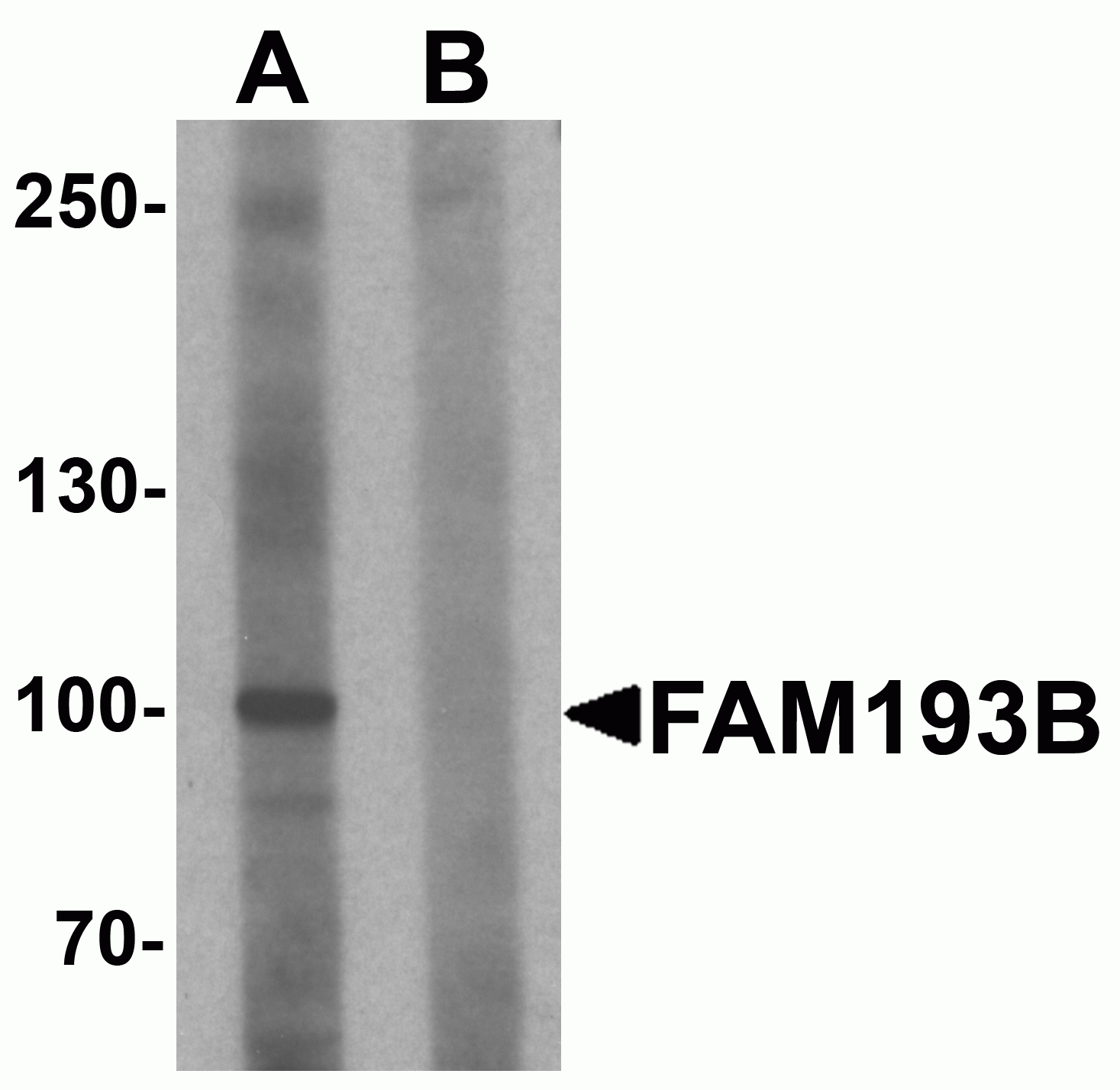 FAM193B Antibody