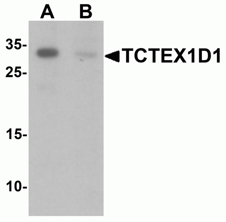 TCTEX1D1 Antibody