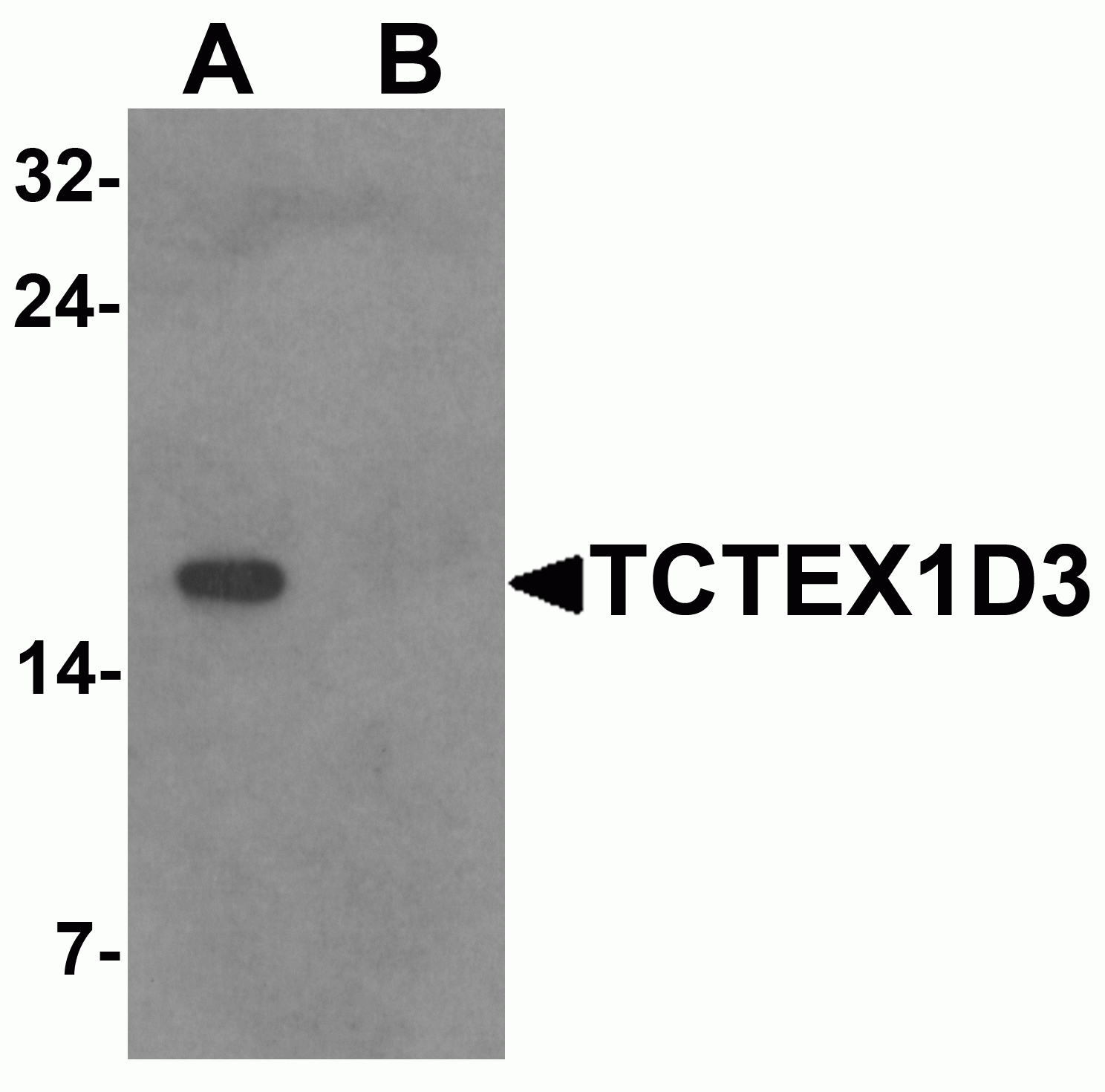 TCTEX1D3 Antibody