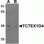 Western blot analysis of TCTEX1D4 in mouse liver tissue lysate with TCTEX1D4 antibody at 1 μg/mL in (A) the absence and (B) the presence of blocking peptide.