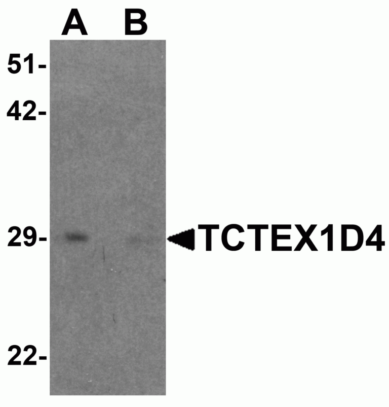 TCTEX1D4 Antibody