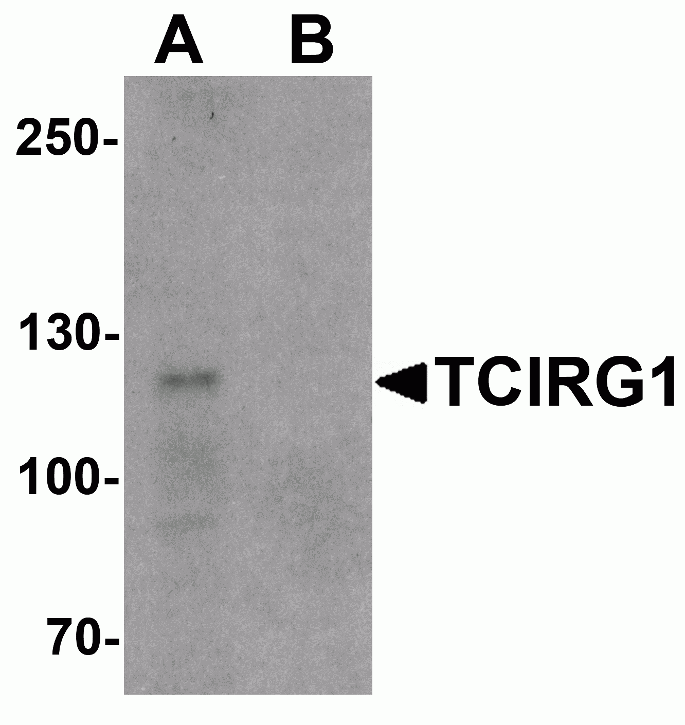 TCIRG1 Antibody