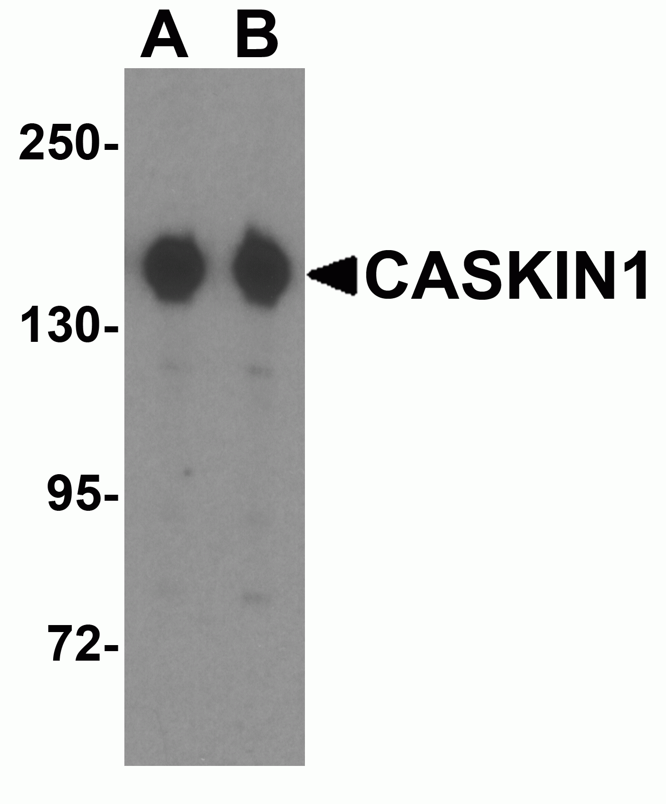 CASKIN1 Antibody