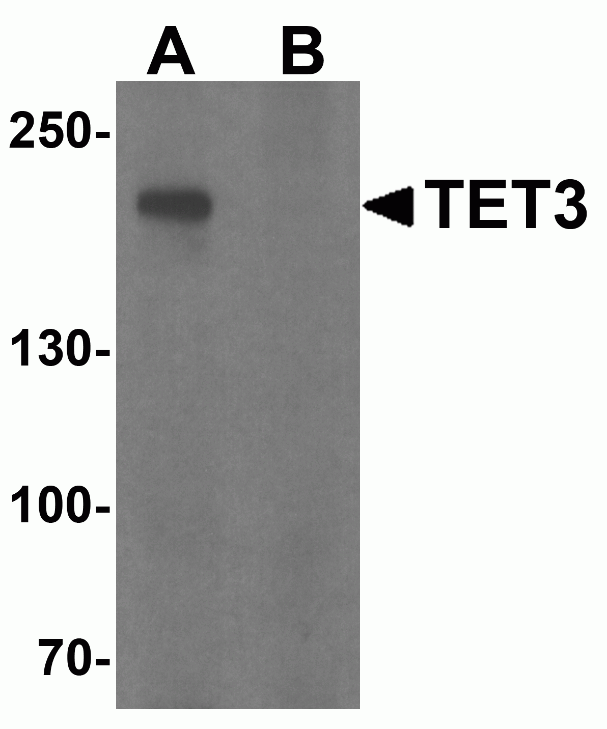 TET3 Antibody