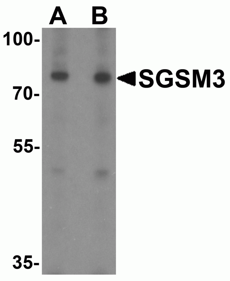 SGSM3 Antibody