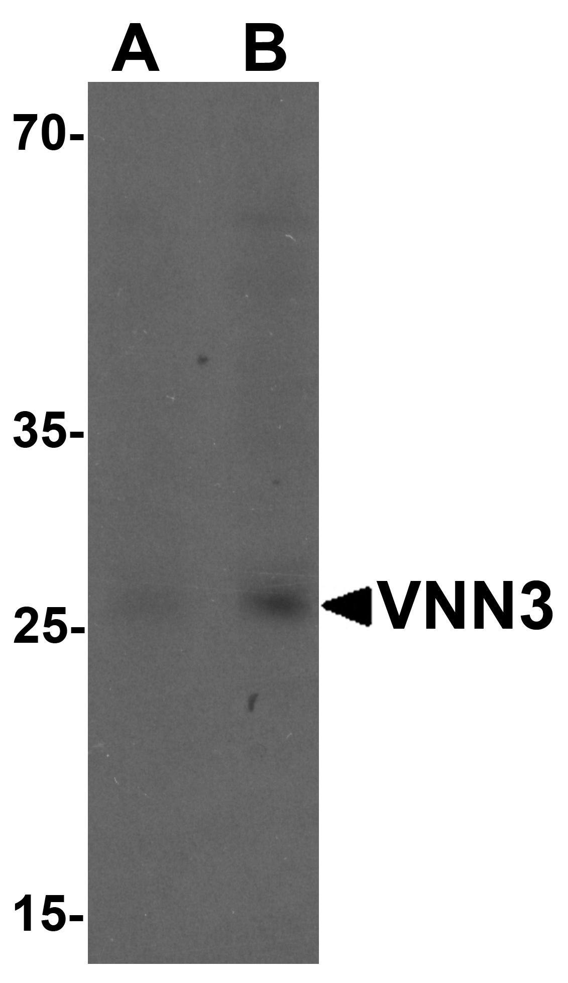 VNN3 Antibody