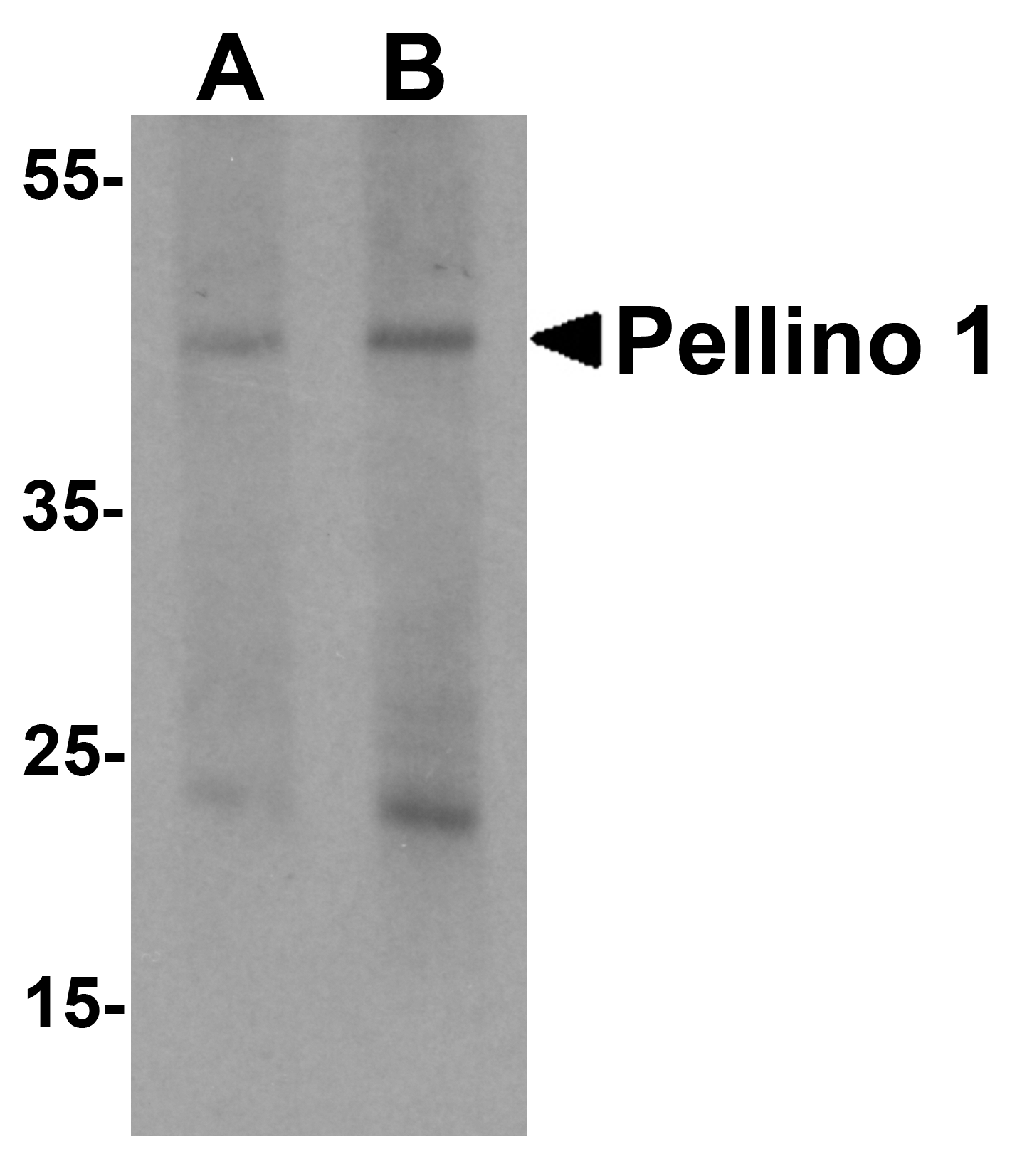 Pellino 1 Antibody
