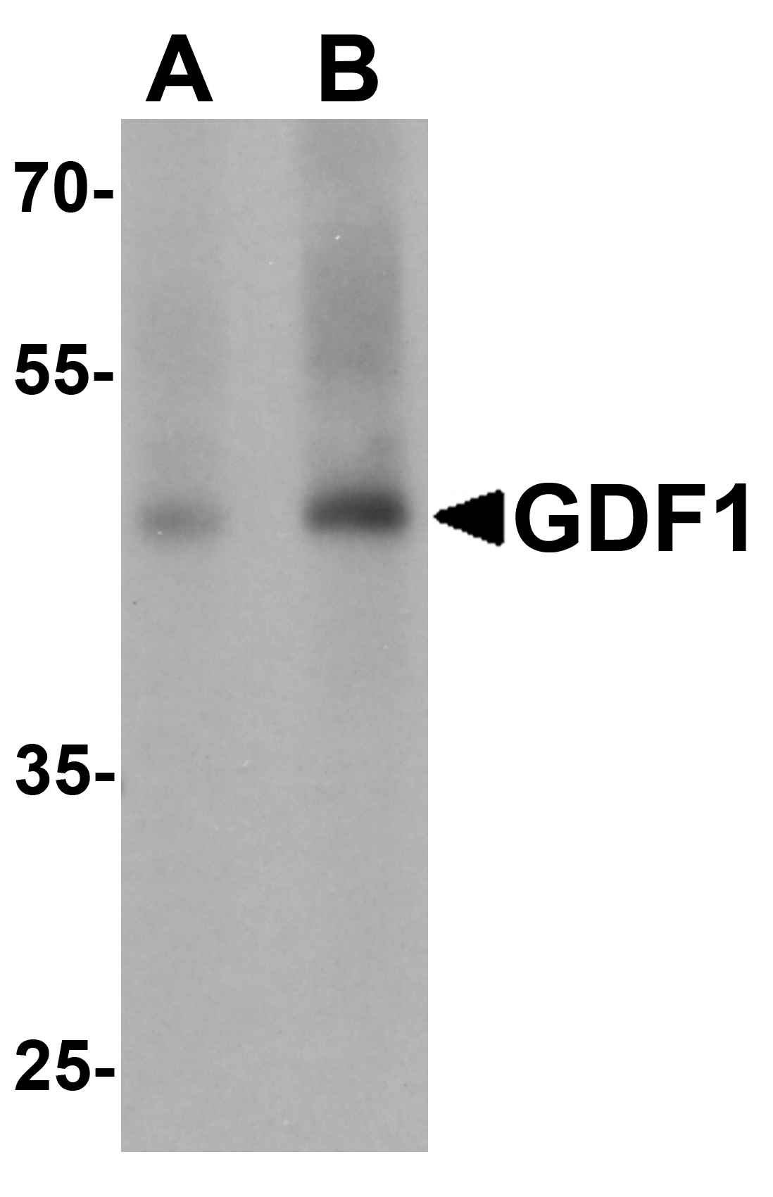 GDF1 Antibody