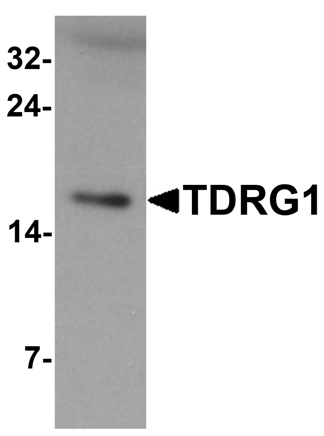 TDRG1 Antibody